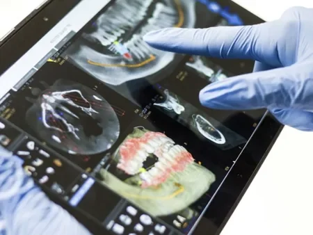 Prothèse dentaire sans métal et biomatériaux au cabinet du Dr Thierry Krief à Nice